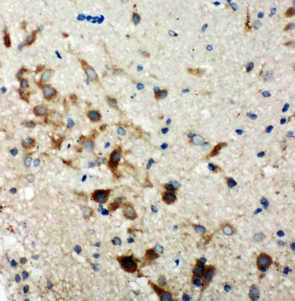 pa2012 3 IHC anti hamartin antibody