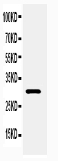 Anti-Adiponectin antibody, PA2014-1, Western blottingWB: Rat Heart Tissue Lysate