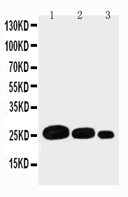 Anti-Adiponectin antibody, PA2014-1, Western blottingRecombinant Protein Detection Source: E