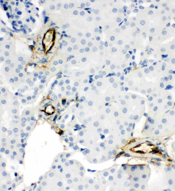 pa2014 1 4 IHC anti adiponectin antibody