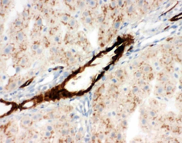pa2014 1 5 IHC anti adiponectin antibody