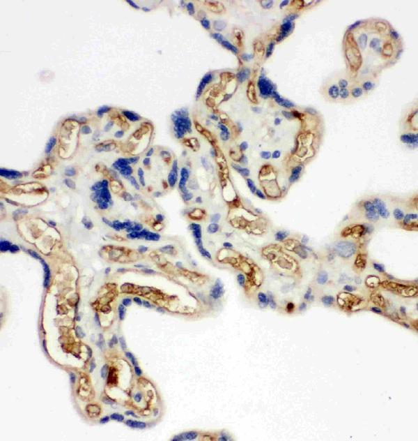 pa2014 1 6 IHC anti adiponectin antibody