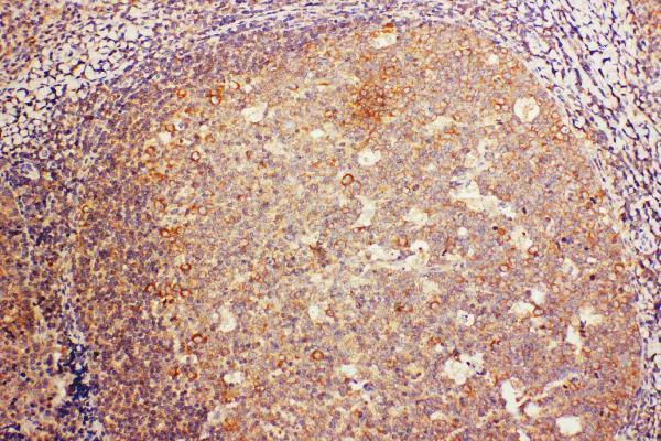 pa2018 2 IHC anti cd68 sr d1 antibody