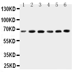pa2019 1 WB anti cetp antibody