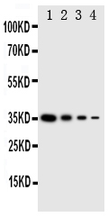 Anti-GCN2 antibody, PA2028, Western blotting Recombinant Protein Detection Source: E.coli derived -recombinant Mouse EIF2AK4, 35.3KD (162aa tag+ E801-R954) Lane 1: Recombinant Mouse EIF2AK4 Protein 10ng Lane 2: Recombinant Mouse EIF2AK4 Protein 5ng Lane 3: Recombinant Mouse EIF2AK4 Protein 2.5ng Lane 4: Recombinant Mouse EIF2AK4 Protein 1.25ng