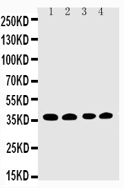Anti-EIF2S1 antibody, PA2029, Western blottingLane 1: COLO320 Cell LysateLane 2: CEM Cell LysateLane 3: RAJI Cell LysateLane 4: HT1080 Cell Lysate