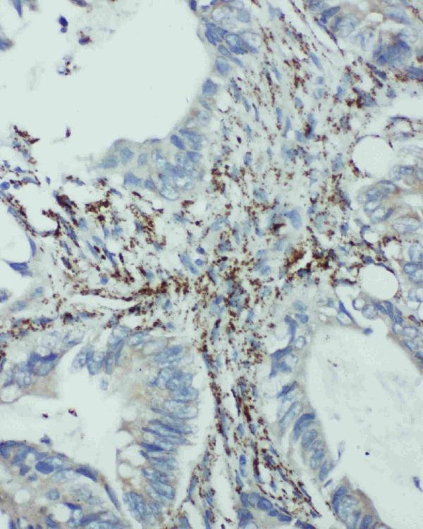 pa2031 2 IHC anti eif6 antibody