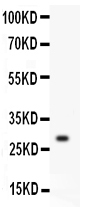 Anti-Kallikrein 1 antibody, PA2038,Western blottingAll lanes: Anti Kallikrein 1 (PA2038) at 0