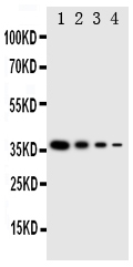 pa2039 1 WB anti ntal antibody