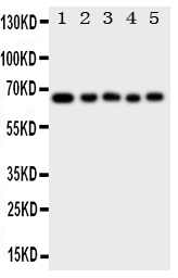 pa2042 2 WB anti mbd4 antibody