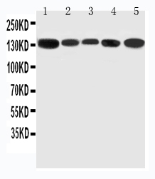 Anti-RGS3 antibody, PA2050, Western blotting Lane 1: Rat Testis Tissue Lysate Lane 2: Rat Brain Tissue Lysate Lane 3: Rat Spleen Tissue Lysate Lane 4: HELA Cell Lysate Lane 5: U87 Cell Lysate