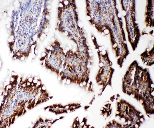 pa2050 2 IHC anti rgs3 antibody