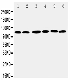 Anti-RSK1 p90 antibody, PA2052, Western blottingLane 1: MCF-7 Cell LysateLane 2: HELA Cell LysateLane 3: K562 Cell LysateLane 4: JURKAT Cell LysateLane 5: SW620 Cell LysateLane 6: RAJI Cell Lysate