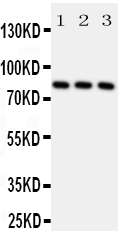 Anti-RSK1 p90 antibody, PA2052, All Western blottingAll lanes: Anti-RPS6KA1 (PA2052) at 0