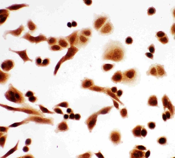 pa2056 5 IF anti p63 antibody