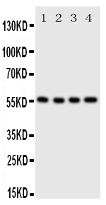 pa2064 2 WB anti slc2a5 glut5 antibody