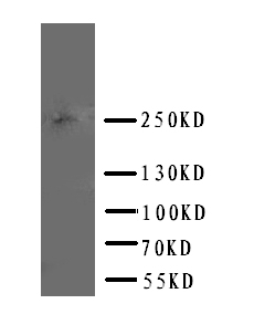 pa2065 1 WB anti abca4 antibody