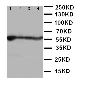 Anti-ALDH2 antibody, PA2073, Western blottingLane 1: Rat Liver Tissue LysateLane 2: Rat Intestine Tissue LysateLane 3: Rat Lung Tissue LysateLane 4: Rat Kidney Tissue Lysate