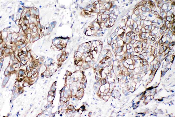 pa2079 2 IHC anti ve cadherin cd144 antibody