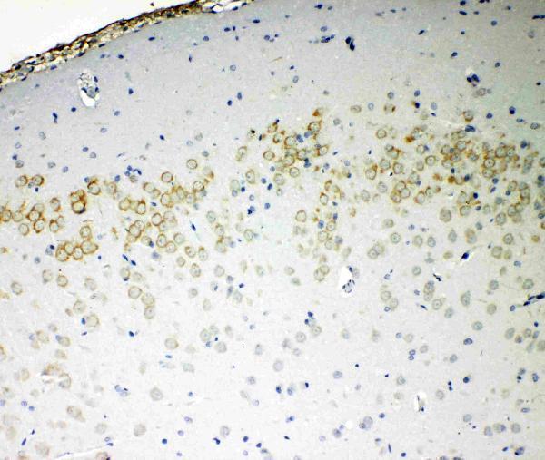 pa2079 3 IHC anti ve cadherin cd144 antibody