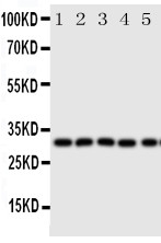 Anti-Aquaporin 9 antibody, PA2094, Western blottingAll lanes: Anti Aquaporin 9 (PA2094) at 0