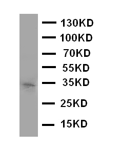 Anti-Aquaporin 10 antibody, PA2095, Western blotting WB: COLO320 Cell Lysate