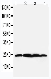 pa2099 1 WB anti bag2 antibody
