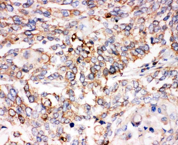 pa2114 2 IHC anti smad1 antibody
