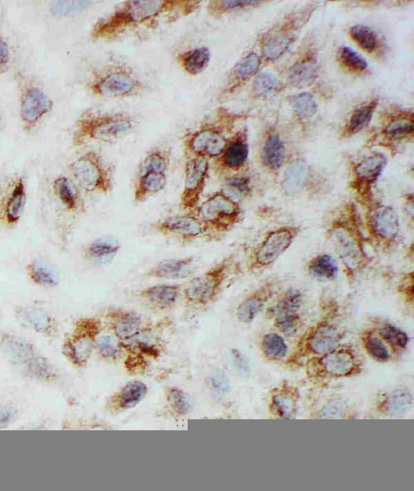pa2114 3 IF anti smad1 antibody