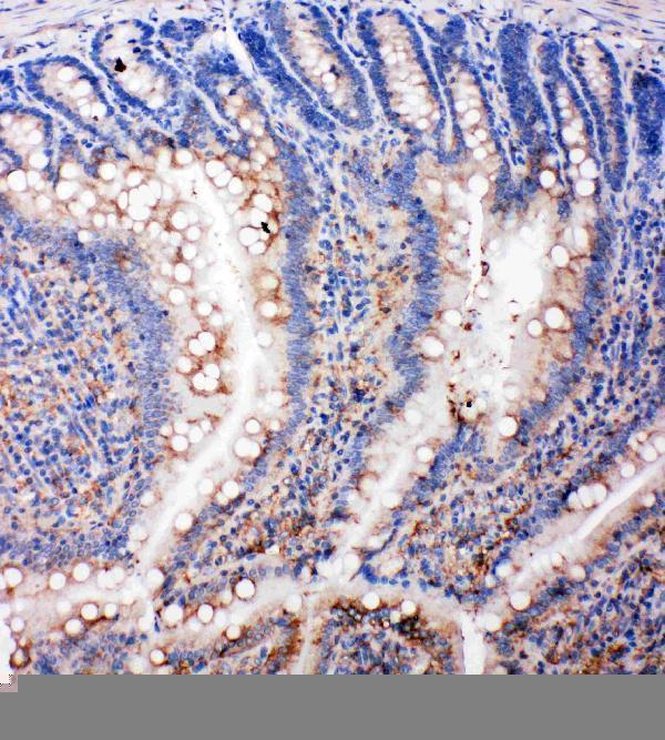 pa2115 1 IHC anti smad5 antibody