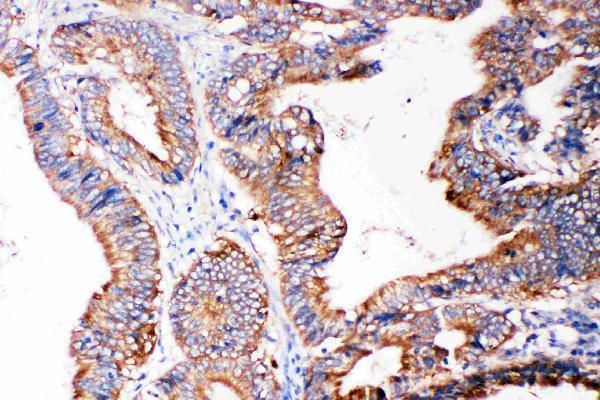 pa2115 2 IHC anti smad5 antibody