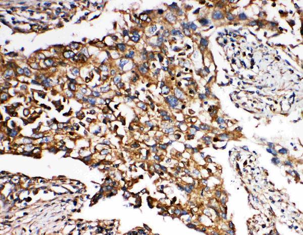 pa2115 3 IHC anti smad5 antibody