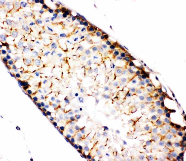 pa2117 1 IHC anti nak antibody