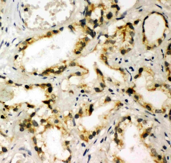 pa2117 2 IHC anti nak antibody