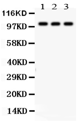 pa2117 3_1 WB anti nak antibody