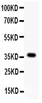 pa2121 1 WB anti wnt4 antibody