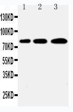  Western blot analysis of PLK2/Snk using anti-PLK2/Snk antibody (PA2131)
