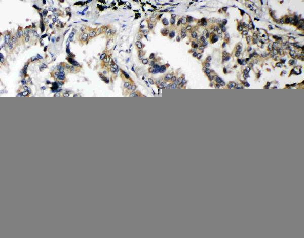  IHC analysis of PLK2/Snk using anti-PLK2/Snk antibody (PA2131)