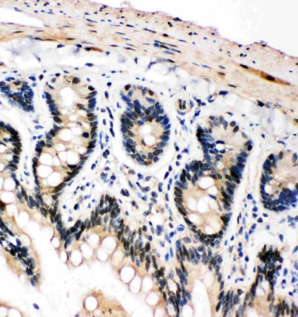  IHC analysis of PLK2/Snk using anti-PLK2/Snk antibody (PA2131)