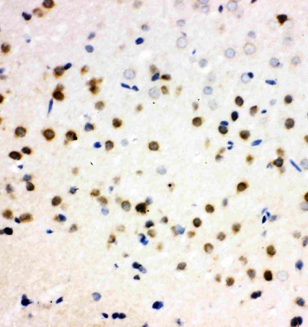 pa2131 4 IHC anti plk2 snk antibody