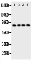 pa2132 1 WB anti parathyroid hormone receptor 1 antibody
