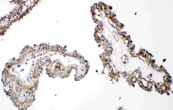 pa2132 2 IHC anti parathyroid hormone receptor 1 antibody