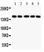 Anti-COL2A1 antibody, PA2141, Western blottingAll lanes: Anti COL2A1 (PA2141) at 0