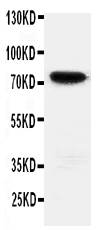 pa2145 1 WB anti hif3 antibody
