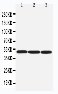 pa2155 2 WB anti beta arrestin 1 antibody