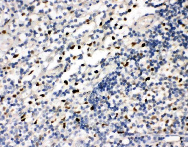 pa2179 1 IHC anti fli1 antibody