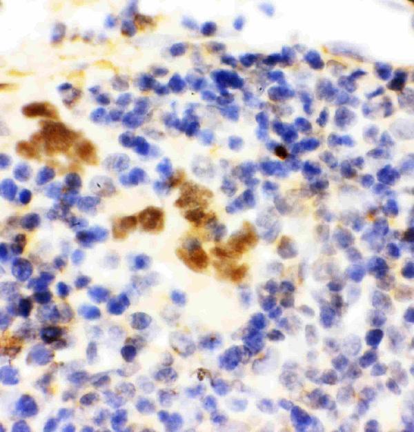 pa2179 3 IHC anti fli1 antibody