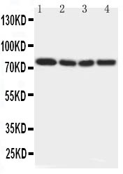 Anti-IRAK antibody, PA2183, Western blottingLane 1: Rat Liver Tissue LysateLane 2: Human Placenta Tissue LysateLane 3: MCF-7 Cell LysateLane 4: PANC Cell Lysate