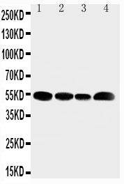 Anti-SLC16A4 antibody, PA2189, Western blotting Lane 1: Rat Testis Tissue Lysate Lane 2: JURKAT Cell Lysate Lane 3: HELA Cell Lysate Lane 4: MCF-7 Cell Lysate