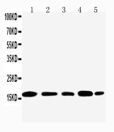 Anti-TIA1 antibody, PA2194, Western blotting Lane 1: JURKAT Cell Lysate Lane 2: RAJI Cell Lysate Lane 3: CEM Cell Lysate Lane 4: HT1080 Cell Lysate Lane 5: K562 Cell Lysate